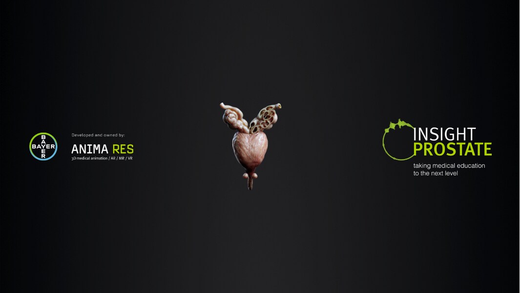 Insight_Prostate_WebGL_Header