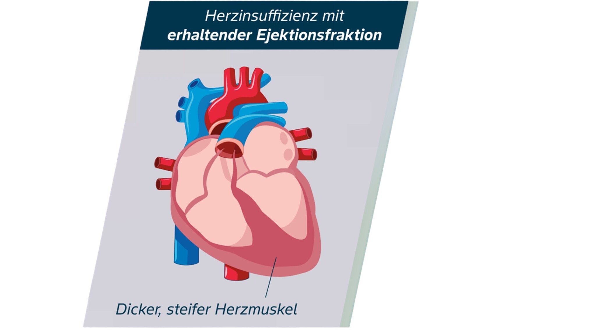 HFpEF Abbildung