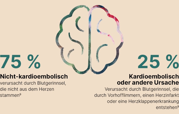 75% nicht kardio-embolisch, 25% kardioembolisch oder andere Ursache